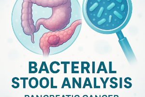 Pancreatic Cancer Found in Stool Samples